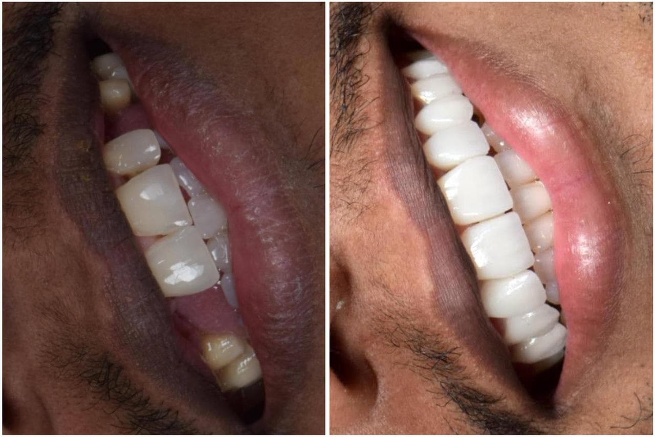 Dentales Center tratamientos